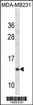IFITM1 Antibody(Center)