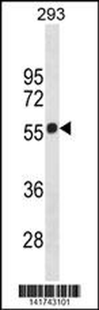 CB1 Antibody (Center)