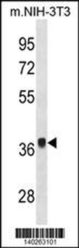 Mouse Fgf8 Antibody(N-term)