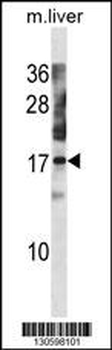 NXT1 Antibody (C-term)