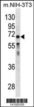 GGT1 Antibody (N-term)