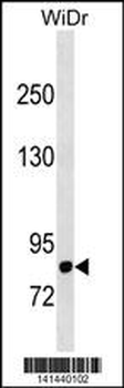 DPP4 Antibody (N-term)