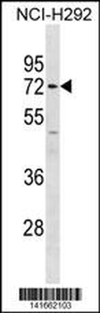 MMP14 Antibody (C-term)