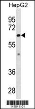 ZMPSTE24 Antibody (C-term)