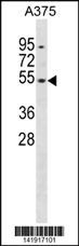 DUSP10 Antibody (Center)