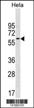 CD3EAP Antibody (N-term)