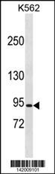 CLCN5 Antibody (N-term)
