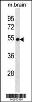 VANGL2 Antibody (N-term)