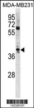 ATOH1 Antibody (C-term)