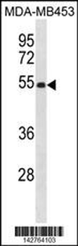 EIF2S2 Antibody (C-term)
