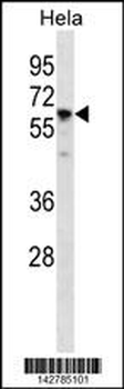 CCT7 Antibody (N-term)