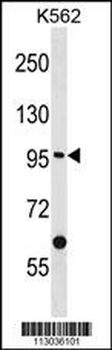 EPHA10 Antibody (Center)