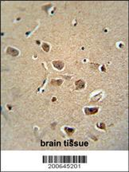 Rat Serpinh1 Antibody (Center)