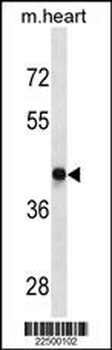 DRD4 Antibody (Center)