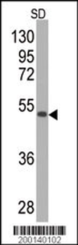 SOD2 Antibody