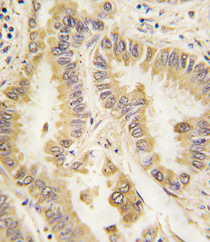 SOD2 Antibody