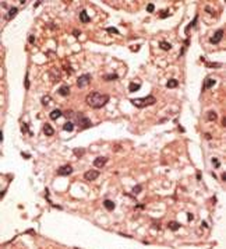 Presenilin 1 Antibody (C-term) [Knockout Validated]