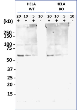 Presenilin 1 Antibody (C-term) [Knockout Validated]