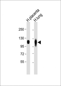 LAMP2 Antibody [Knockout Validated]