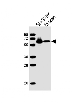 DPYSL5 Antibody