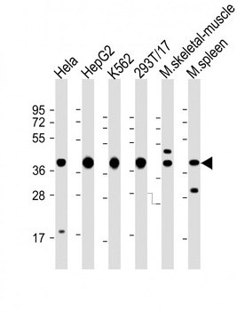 PCBP1 Antibody (Center)
