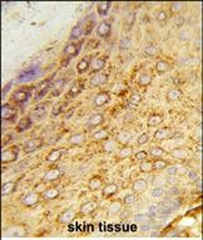 LDHA Antibody (Center)