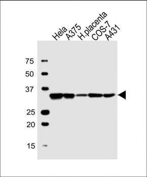 LDHA Antibody (Center)