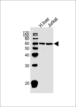 Glycerol kinase (GPK2) Antibody (C-term)