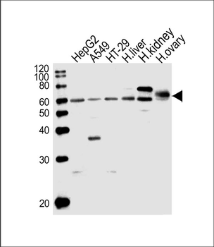 CYP3A4 Antibody (Center)