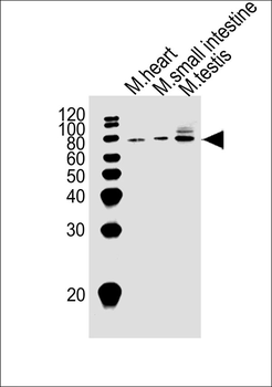 Mouse Klf4 Antibody (Center)