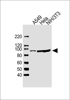 FER Antibody