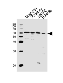 PPP2R1B Antibody (N-term)
