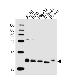 ITPA Antibody (N-term)