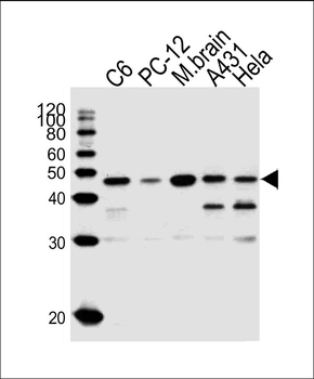 MEK1 (MAP2K1) Antibody (N-term)