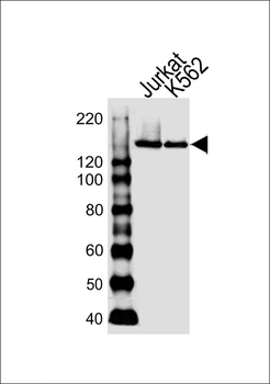 DHX9 Antibody (N-term)