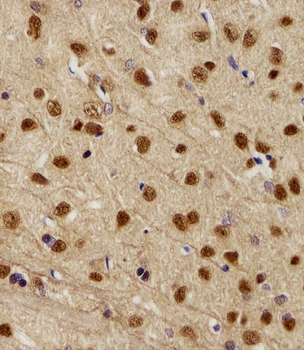 NEK2 Antibody (Center)