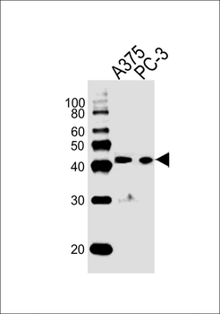 SIRPB1 Antibody (N-term)