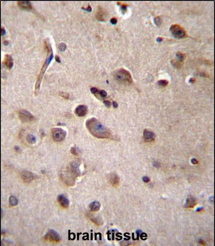 TSN Antibody (Center)