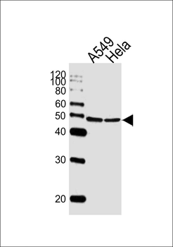 CBX8 Antibody (C-term)