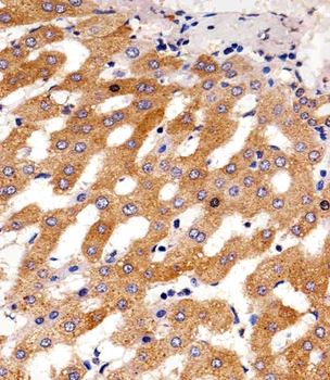 PAH Antibody (Center)