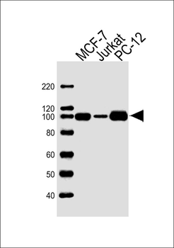 TOP1 Antibody (N-term)