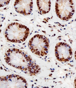 RBX1 Antibody (C-term)