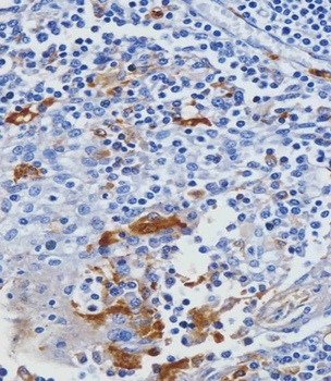 LYZ Antibody (C-term)