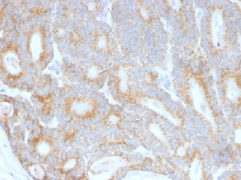 Lewis Y (Tumor Marker) Antibody