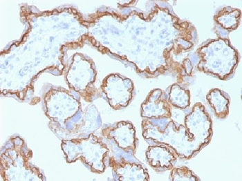 E-Cadherin / CD324 Antibody