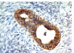 E-Cadherin / CD324 Antibody