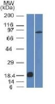 E-Cadherin / CD324 Antibody