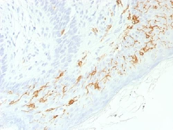 CD1a / HTA1 Antibody