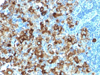 gp100 / Melanosome / PMEL17 / SILV Antibody
