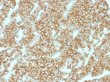 Parathyroid Hormone (PTH) (N-Terminal) Antibody